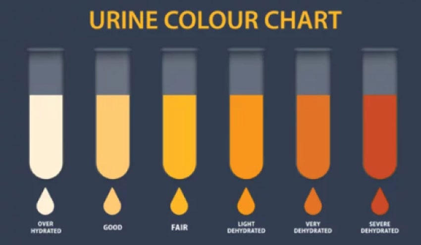 Dehydration Urine Color