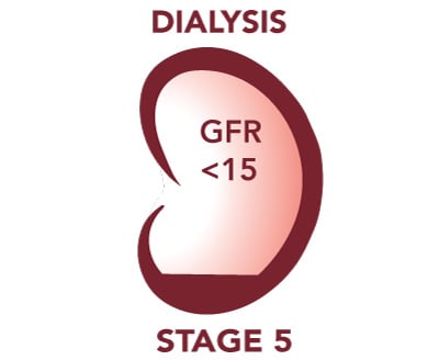 Icon showing significant damage to kidney